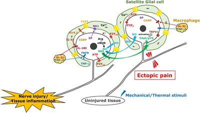 Peripheral and Central Mechanisms of Persistent Orofacial Pain